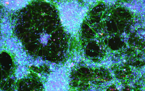 Can a cell therapy for hearing loss be a healthspan blockbuster