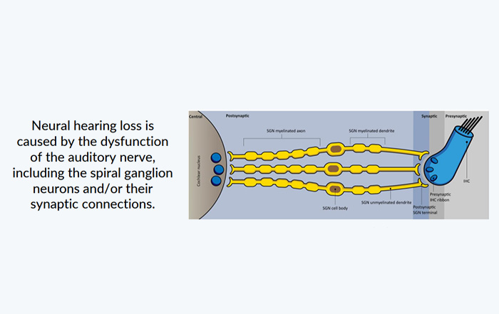 Hope for neural hearing loss